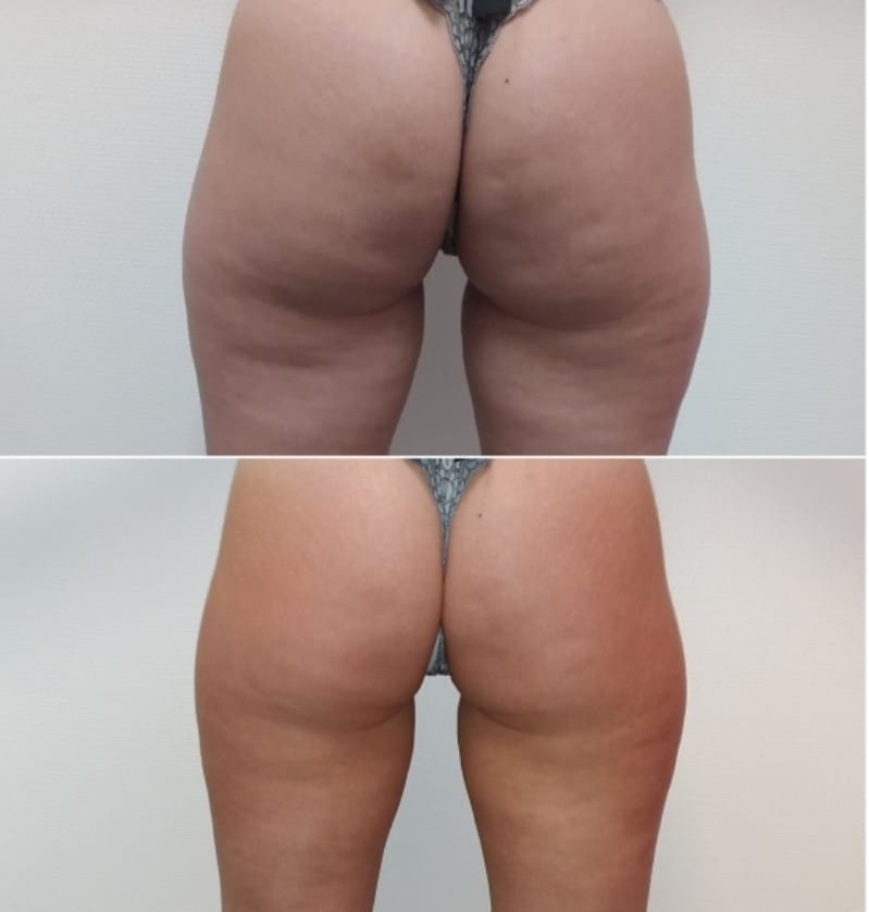 toning glutes