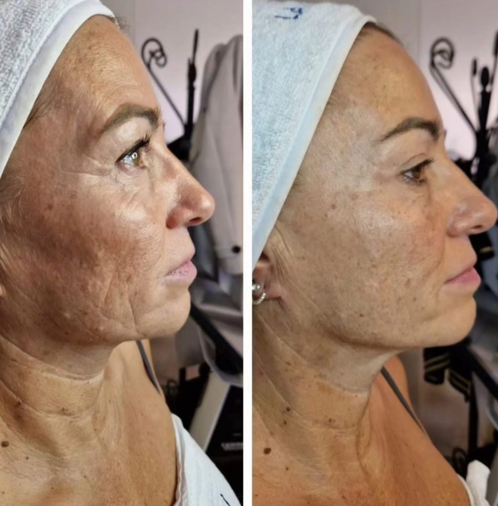 face result
