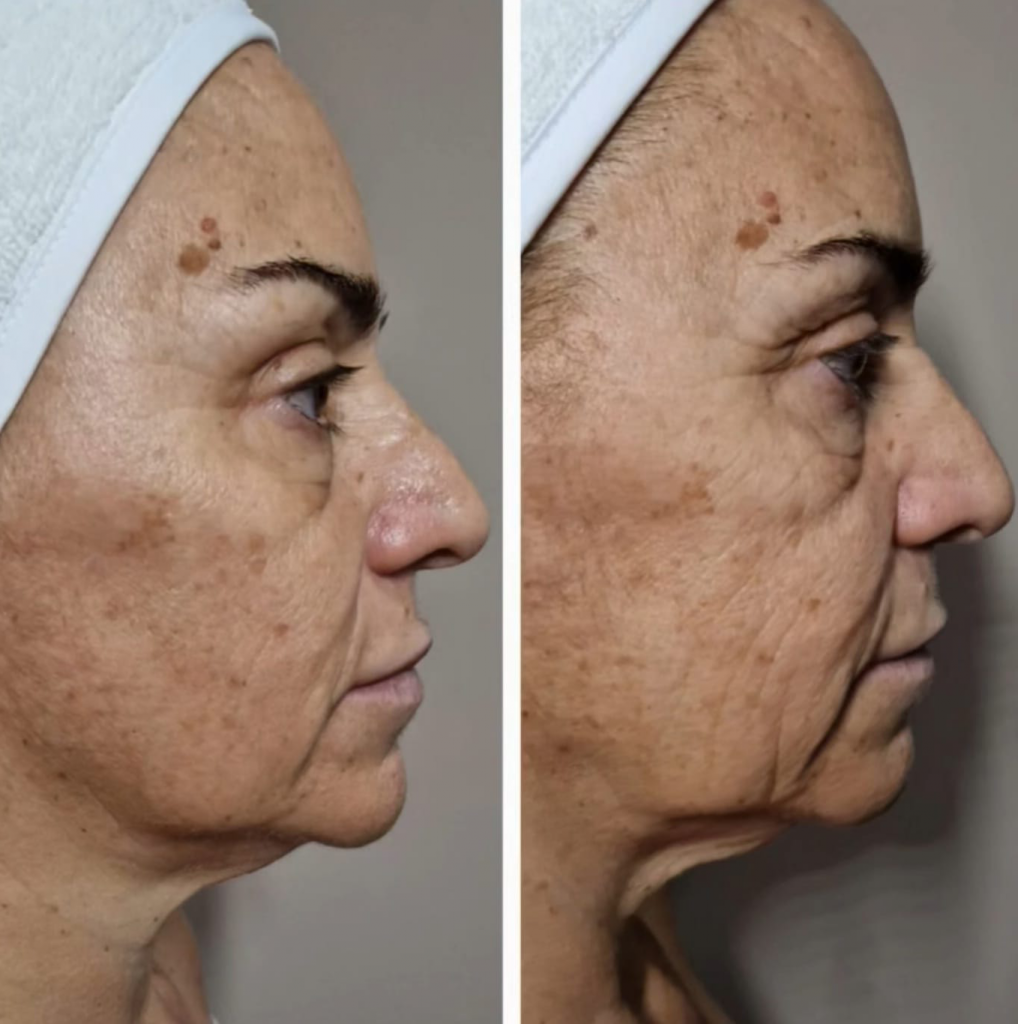 face result