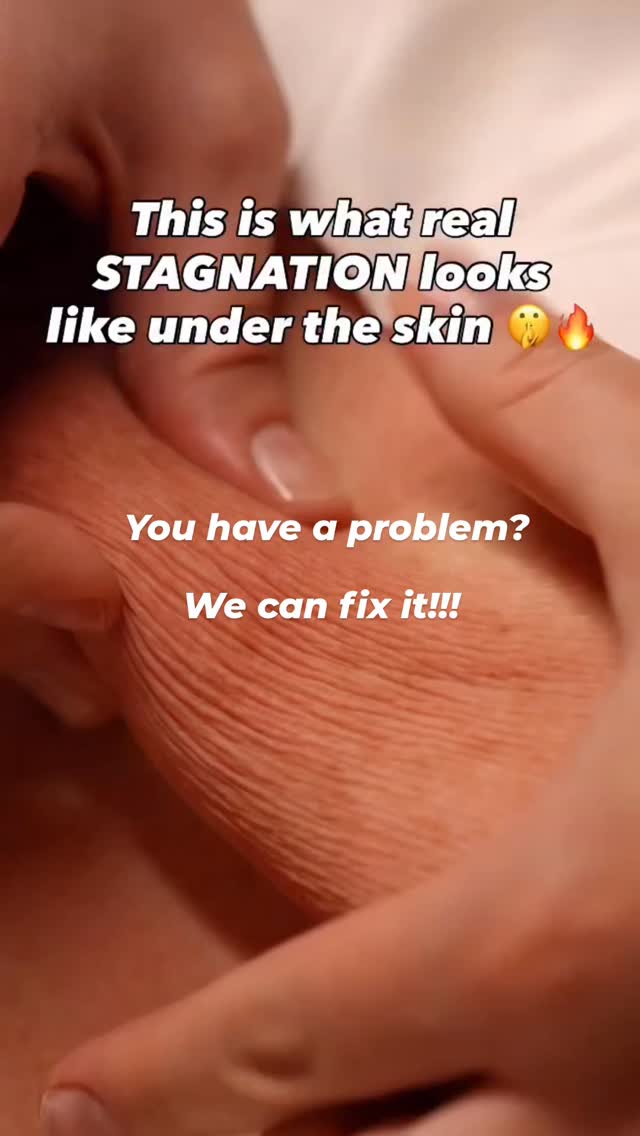 You have a problem? We can fix it!!

Cryoskin magic wand!!!

Cryoslimming. Cryotoning. Cryo cellulite. Cryo drainage. Cryo double chin. Cryo facial. Crho hair.

Problems. Solutions

We are looking for distributors and influencers customers worldwide.

More information:
Contact@cryoskinparis.com
Www.cryoskin-international.com

#wellness #cryotherapy #cryoskin #cryoslimming #IMCAS2026