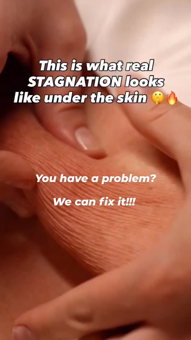 You have a problem? We can fix it!!!

Cryoskin. Cryoslimming. Cryotoning. Cryo cellulite. Cryo drainage. Cryo facial. Cryo hair.

We are looking for distributors and influencers customers worldwide.

More information :
Contact@cryoskinparis.com
Www.cryoskin-international.com

#wellness #cryotherapy #cryoskin #cryoslimming #IMCAS2026